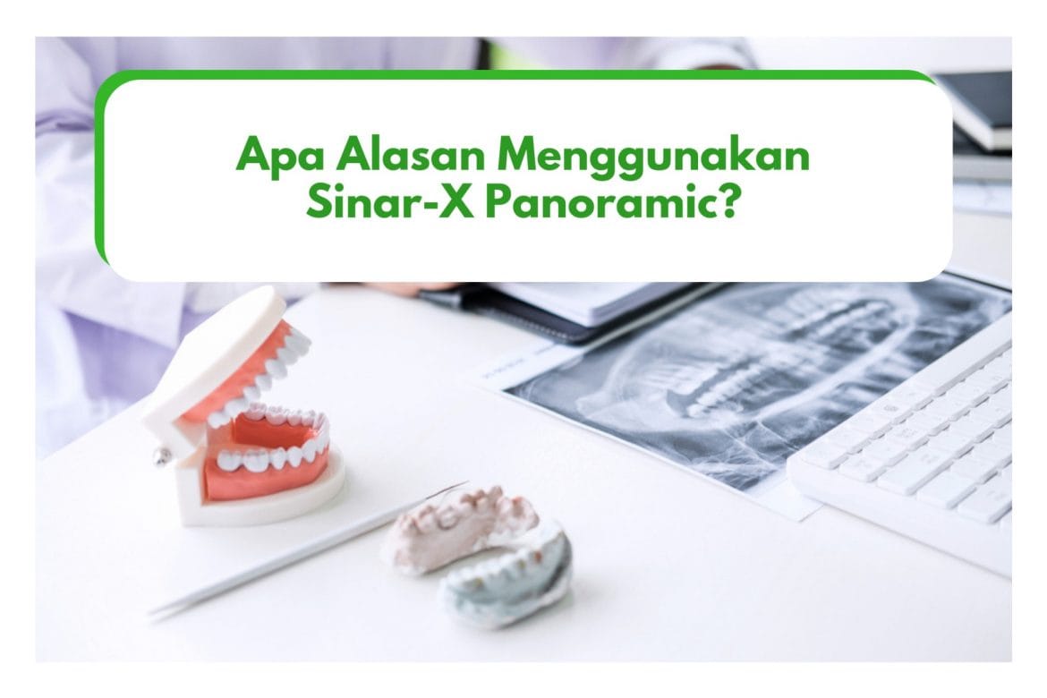 Alasan Menggunakan Sinar-X Panoramic