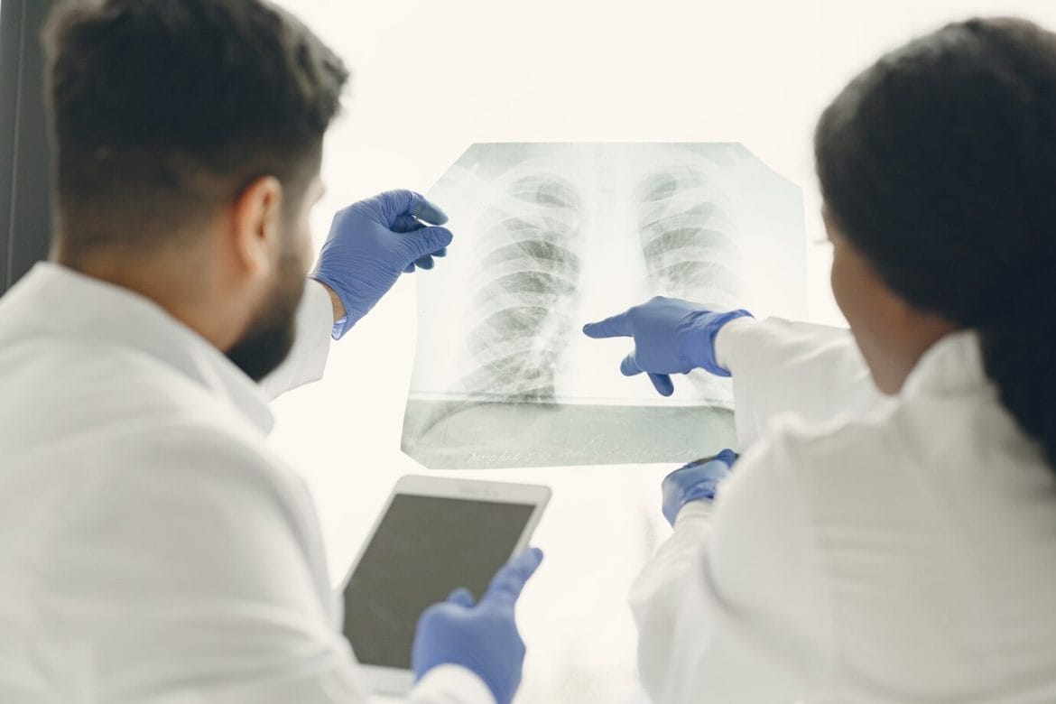 Fakta Penyakit TBC (Tuberkulosis) yang Harus Kamu Tahu