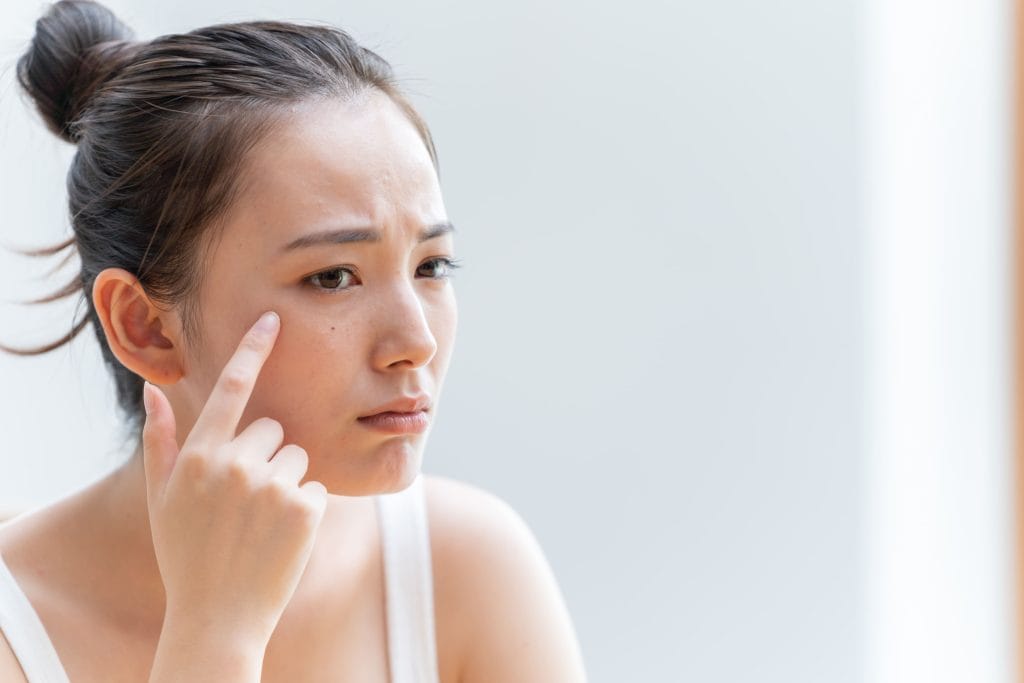 Tanda Skincare Tidak Bekerja dengan Baik