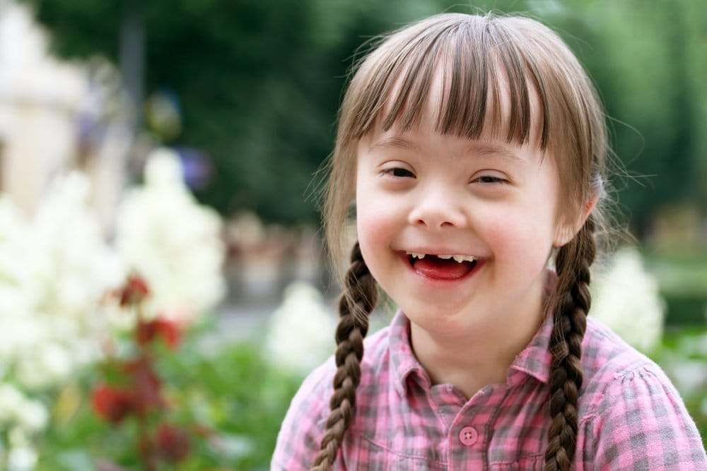 Perbedaan Autis dan Down Syndrome