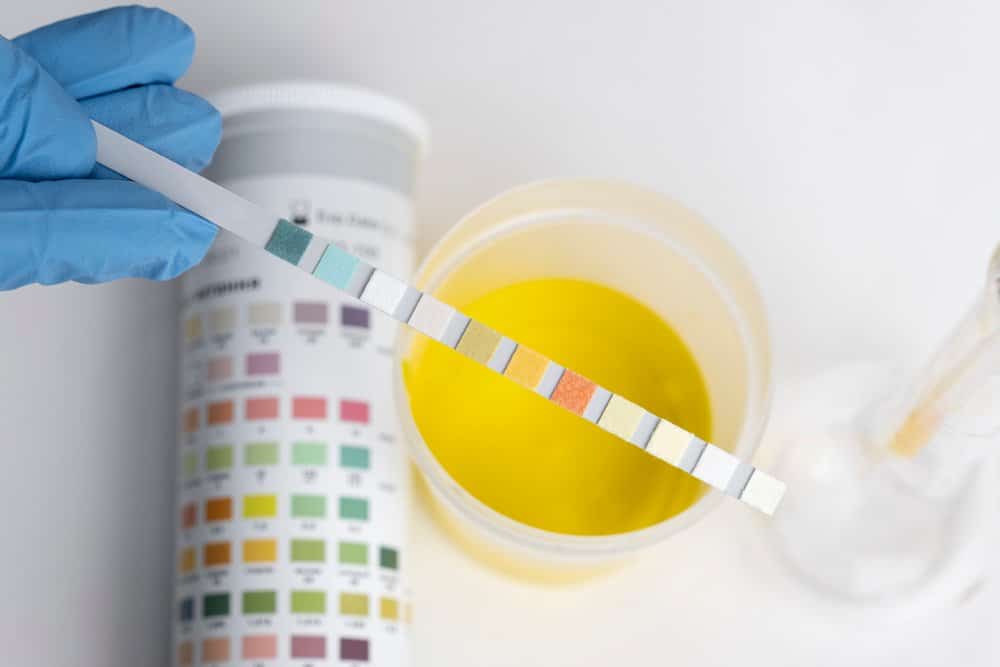 tes urine